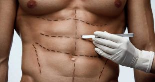 Liposucción masculina: qué es, tipos y lipoesculturas más solicitadas